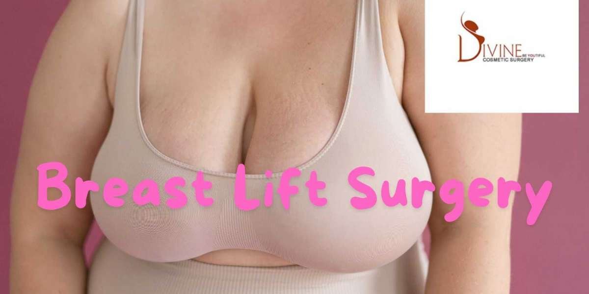 5 Practical Reasons to Consider a Breast Lift