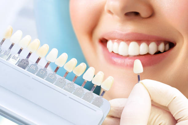 Elevate Your Smile: What Cosmetic Dentistry Offers and What to Expect | Davis and Engert Dentistry
