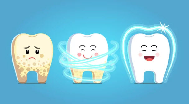 Deep Teeth Cleaning vs Regular Scaling in Singapore - Writeology X - Webflow Memberships Website template
