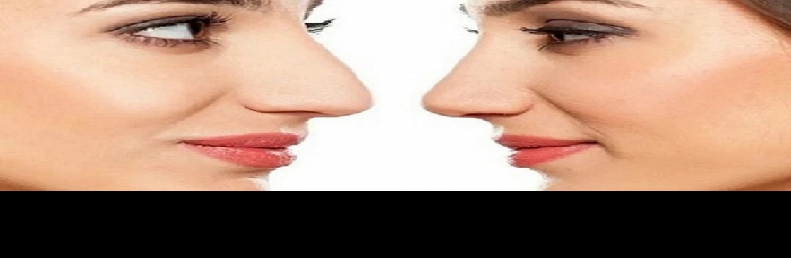 La rinoplastica in Ospedale