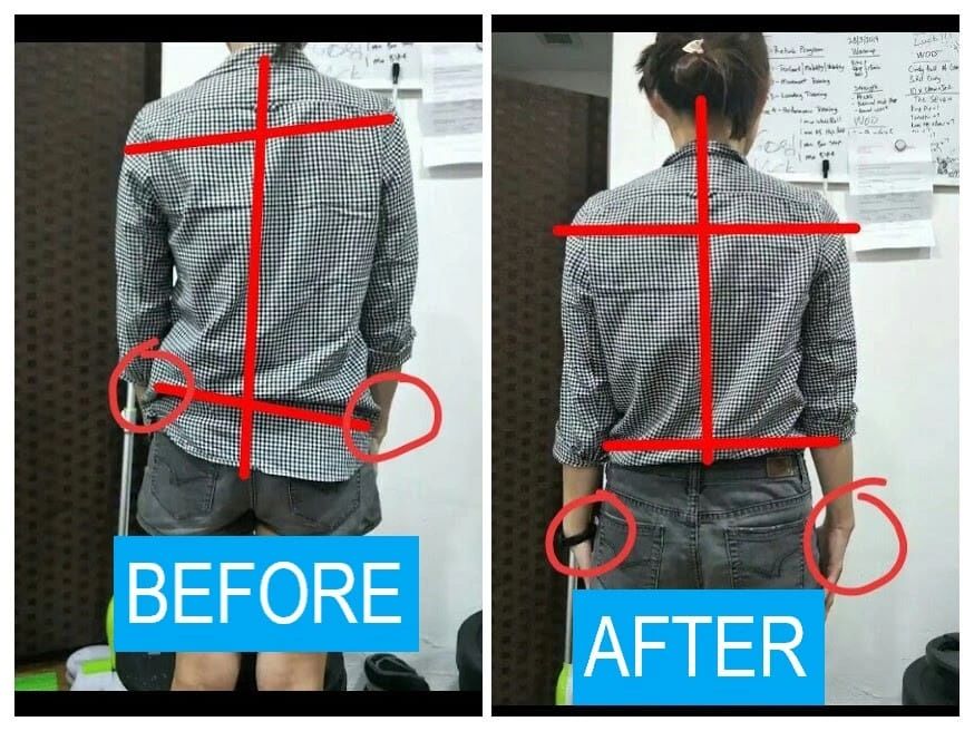 What Exercises Provide the Best Relief for Shoulder Pain Caused b