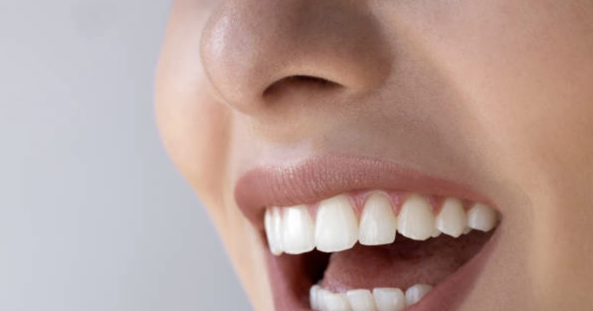 Stoddard Dental Square: Tooth Color Fillings in Mount Roskill, Auckland – A Natural and Modern Approach to Restoring Your Smile