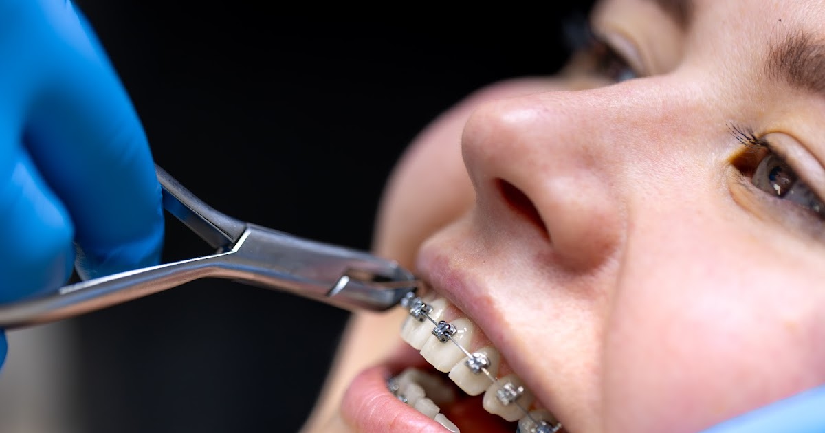 Where Can I Get Affordable Braces in Sheboygan?