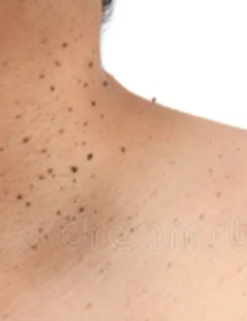 Private Dermatology Clinic in MK | Expert Dermatologists